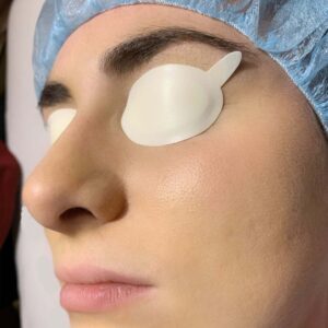 Ipl-eye-shields-disposable-adhesive-eye-shields-for-ipl-visible-and-ir-range-of-500-1-100nm-and-microdermabrasion-box-of-100-50-pair-by-eye-shield-dw-757249-3_1160x_crop_center
