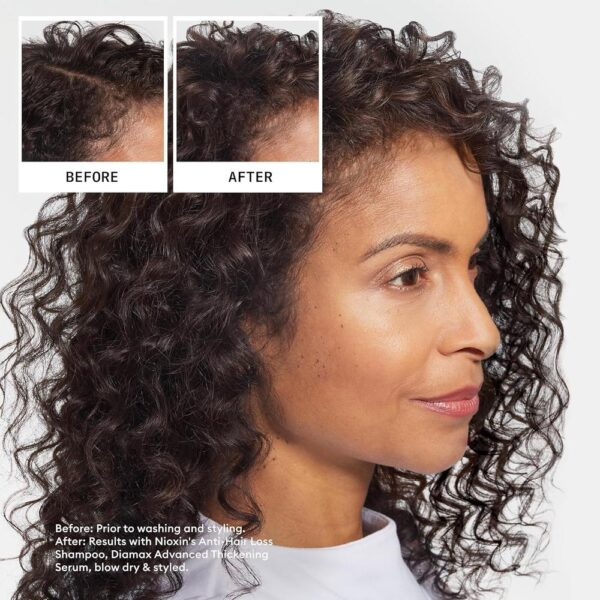 Nioxin-hair-fall-defense-shampoo-16-oz-pb-355585-7_1160x_crop_center