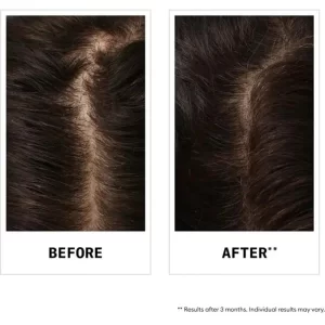 Nioxin-hair-fall-defense-shampoo-16-oz-pb-355585-8_1160x_crop_center